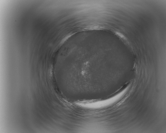 X0000063501161200602032010