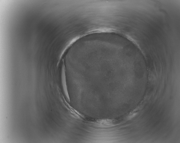 X0000063501171200602032010