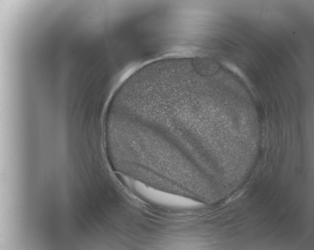 X0000063501467200602032005