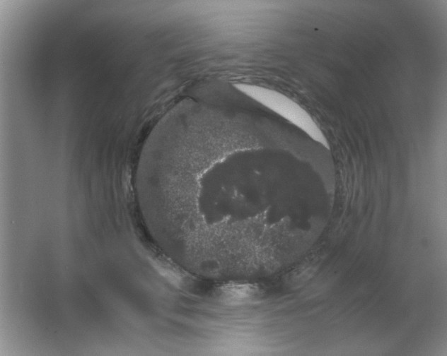 X0000063500711200602101859