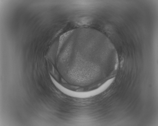 X0000063501156200602101852