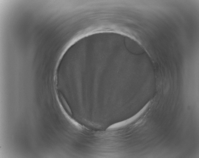 X0000063501519200602101846