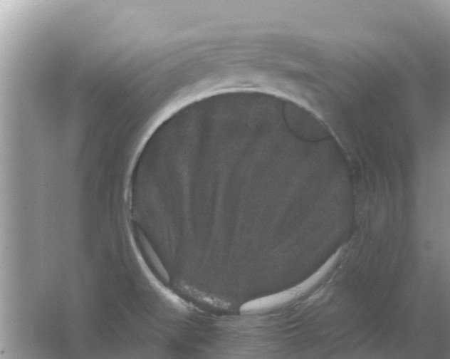 X0000063501519200602172105