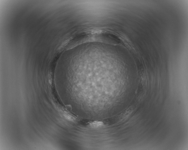 X0000063510374200601201445