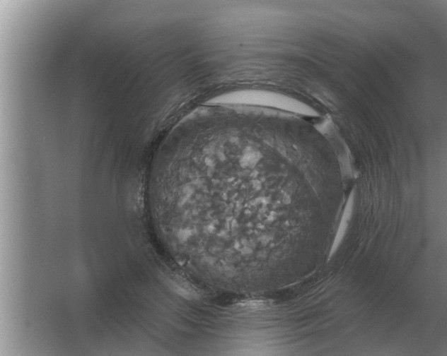 X0000063510499200602032047