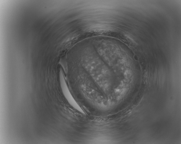 X0000063510917200602032039