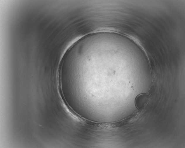 X0000063511003200602032038