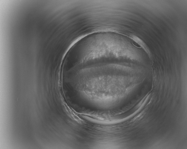 X0000063511052200602032038