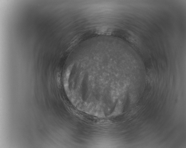 X0000063511154200602032036