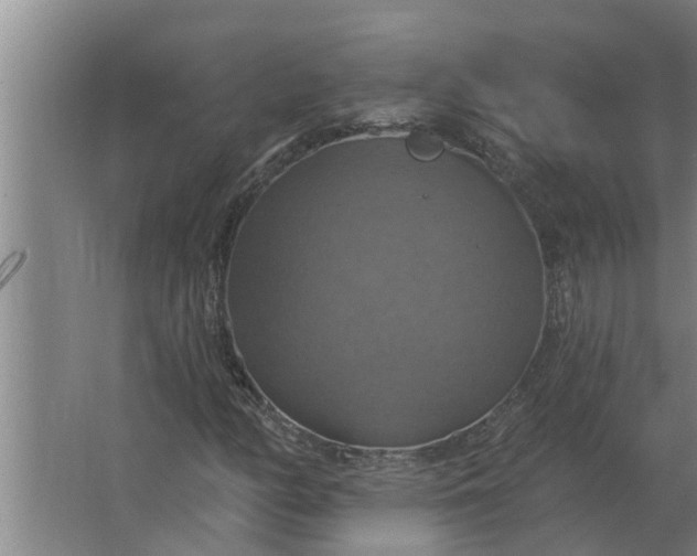 X0000063511158200602032036