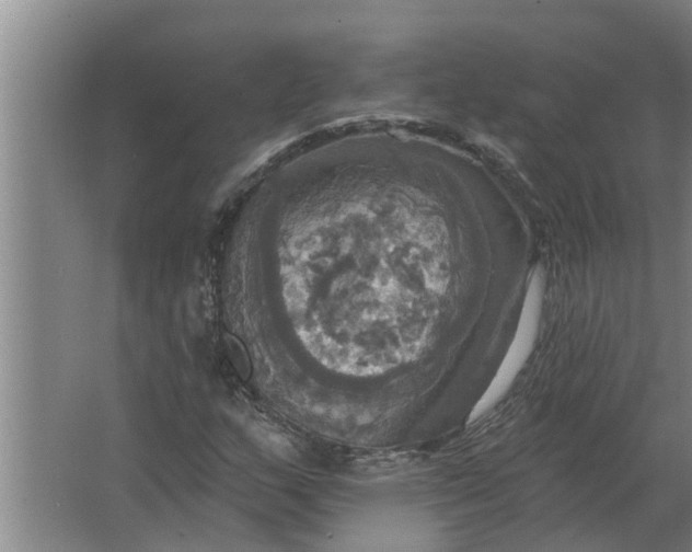 X0000063511159200602032036