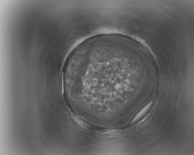 X0000063511175200602032036