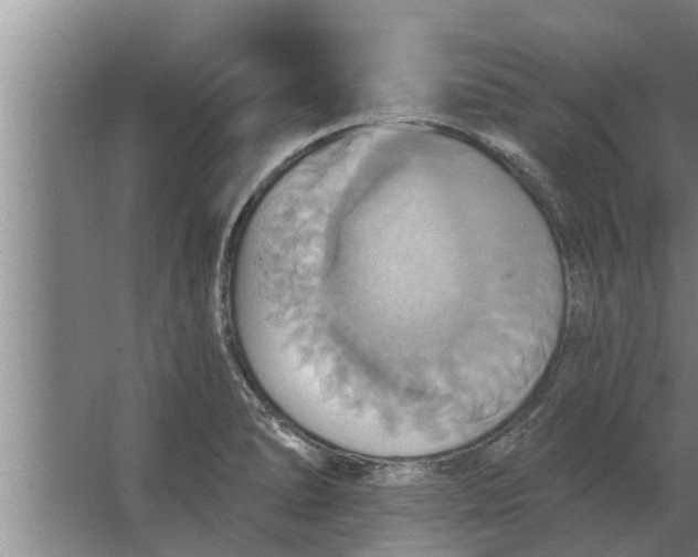 X0000063511278200602032034