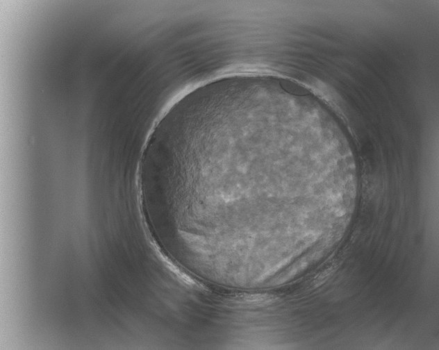 X0000063511382200602032032