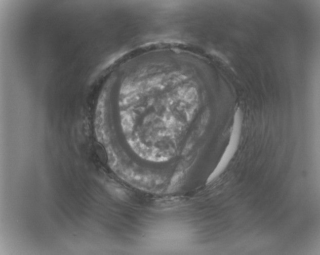 X0000063511159200602101918