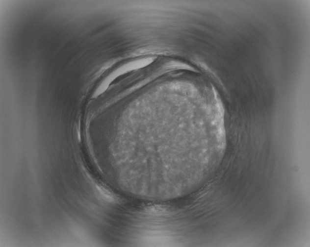 X0000063510062200602172158