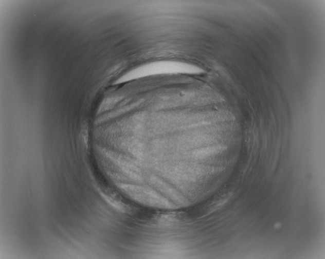 X0000063510072200602172158