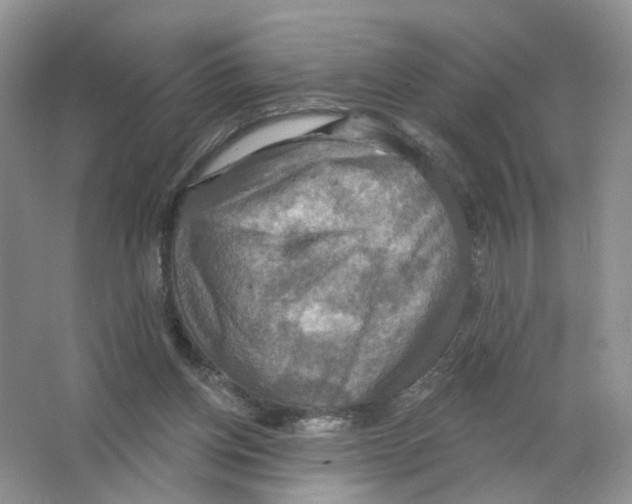 X0000063510158200602172156