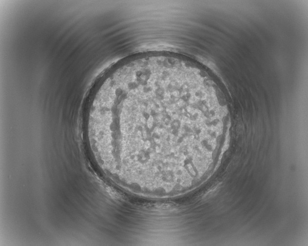 X0000063510979200602172141