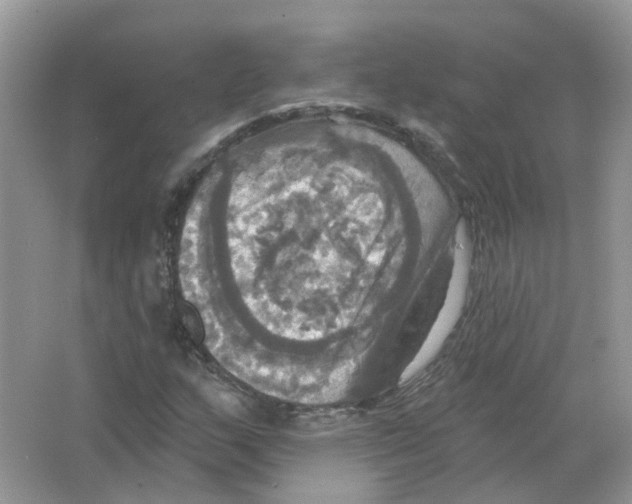 X0000063511159200602172138