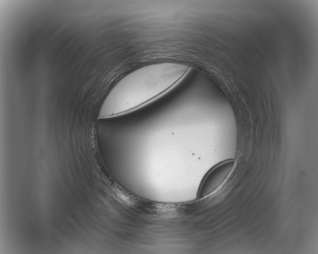 X0000063520144200601201135