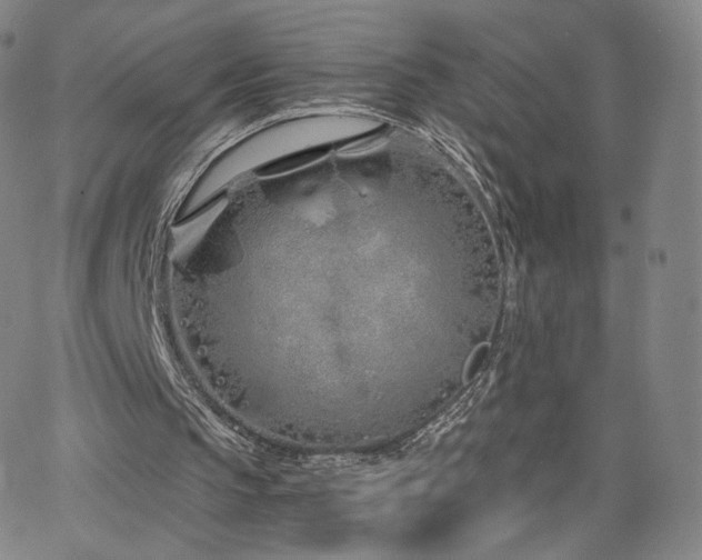 X0000063520145200601201441