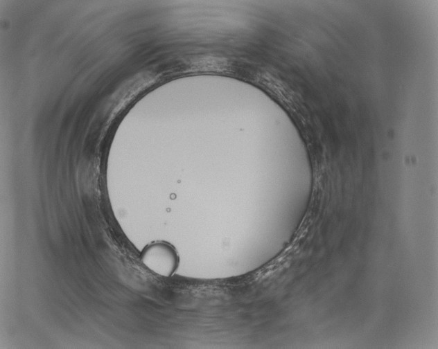 X0000063520146200601201441