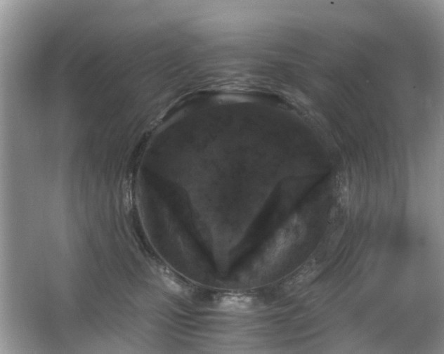 X0000063520471200601231520