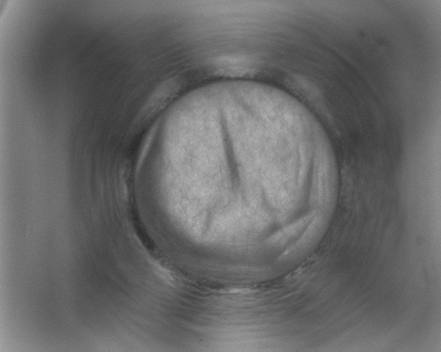 X0000063520114200602102001