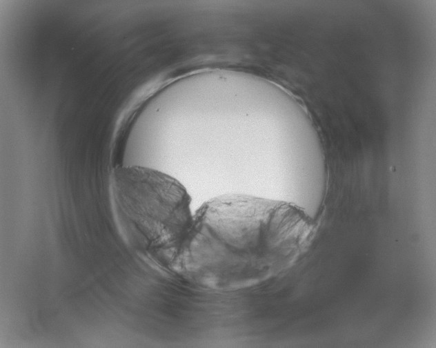 X0000063520149200602102000