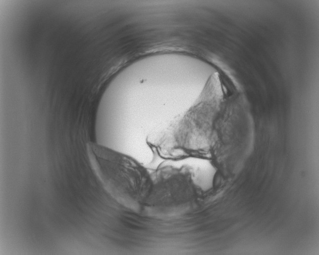 X0000063520153200602102000