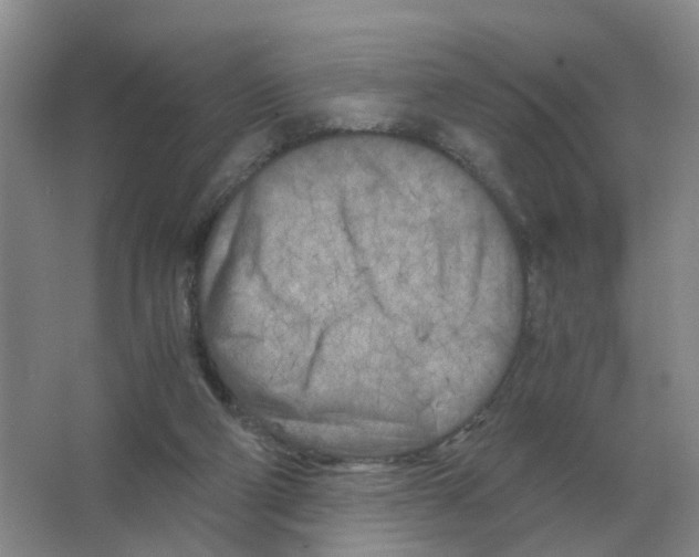 X0000063520114200602172225