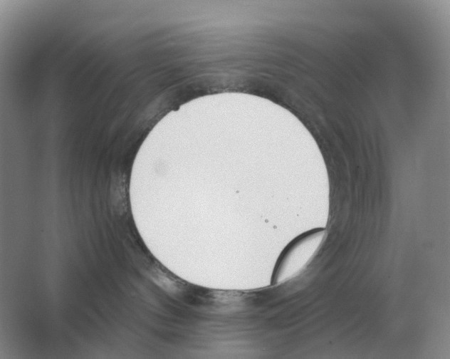 X0000063520144200602172225