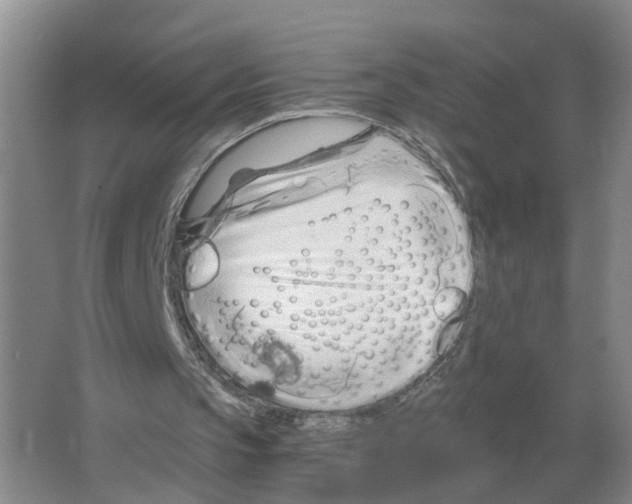 X0000063520145200602172224