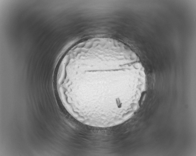 X0000063520147200602172224