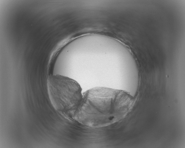 X0000063520149200602172224