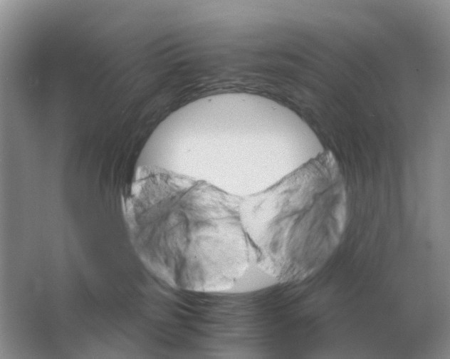 X0000063520185200602172224