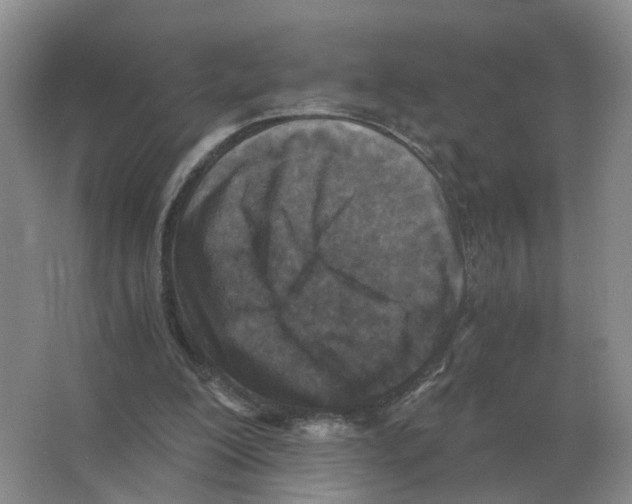 X0000063520200200602172224