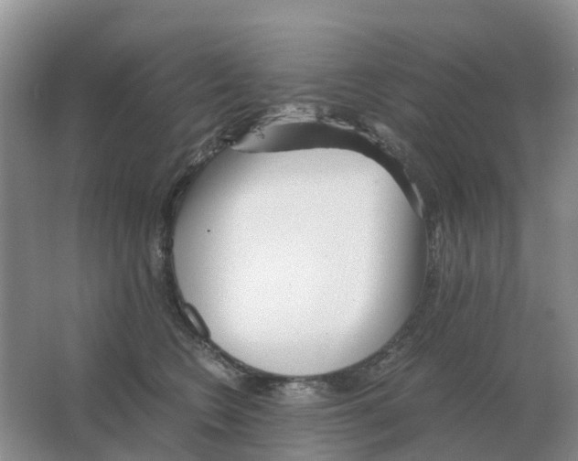 X0000063520566200602172217