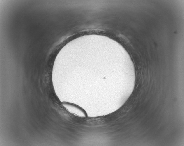 X0000063521159200602172206