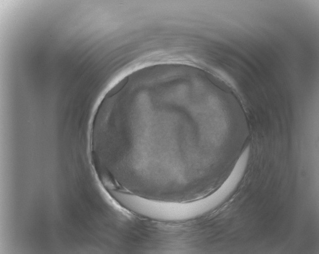 X0000063531528200602172229