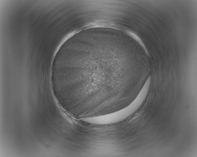 X0000064741146200603031701