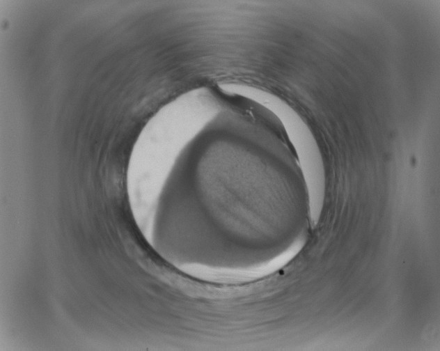 X0000064760039200603131420