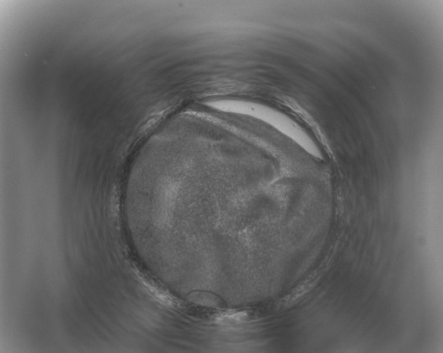 X0000064770257200602242005