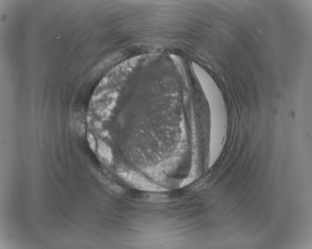 X0000064770719200603131434