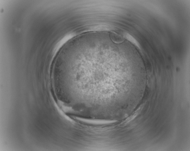 X0000065241087200602242018