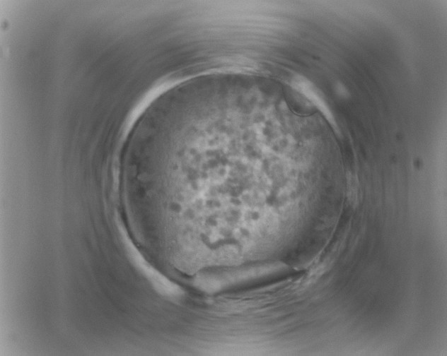 X0000065241099200602242018