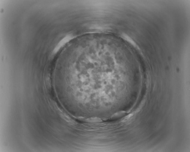 X0000065241259200602242016