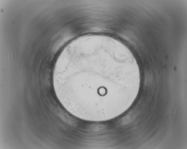 X0000065241314200602242014