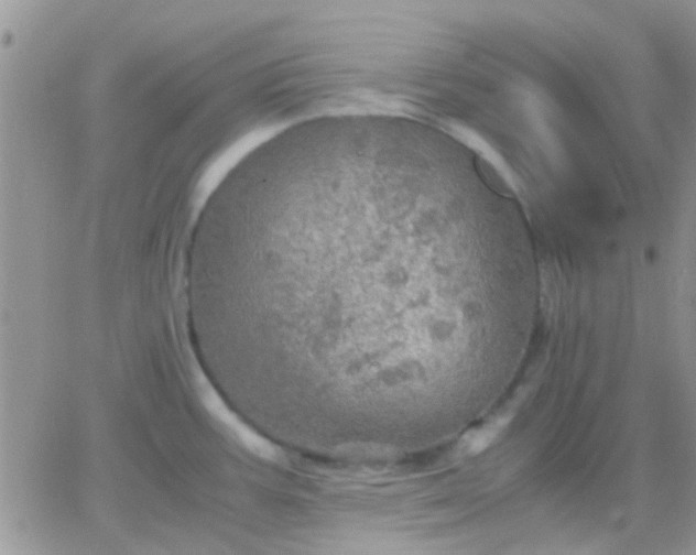 X0000065241387200602242014